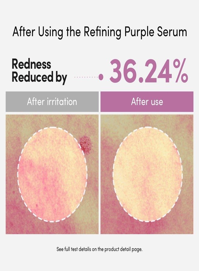 LAGOM Cellus Refining Purple Serum, 10% Azelaic Acid, Ceramide&Panthenol, Herb Extract, Sensitive skin, Redness Soothing, Spot Care, Korean Skincare 1.18 Fl Oz - Image 4